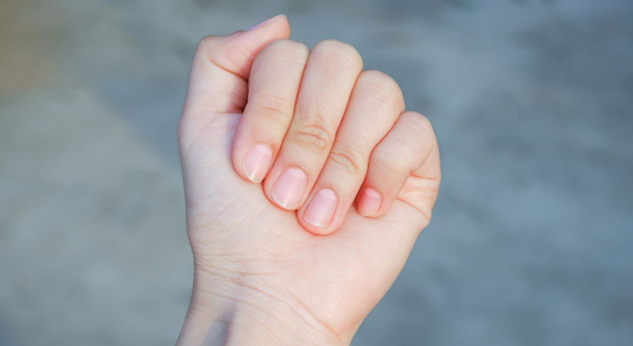 Niedobór, jakiej witaminy odpowiada za białe plamy na paznokciach?