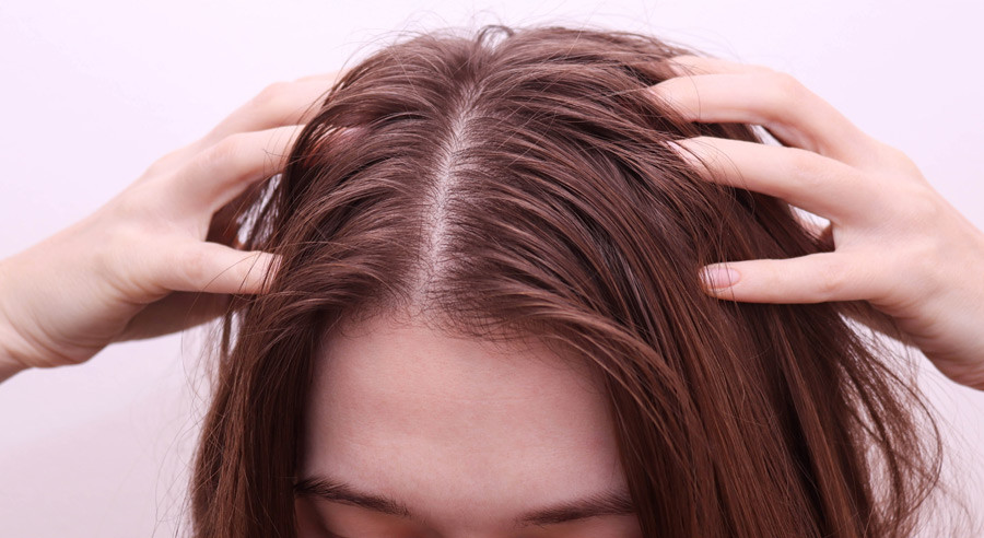 Wypadanie włosów - jakich witamin brakuje i jakie są przyczyny? Zadbaj razem z nami o kondycję włosów